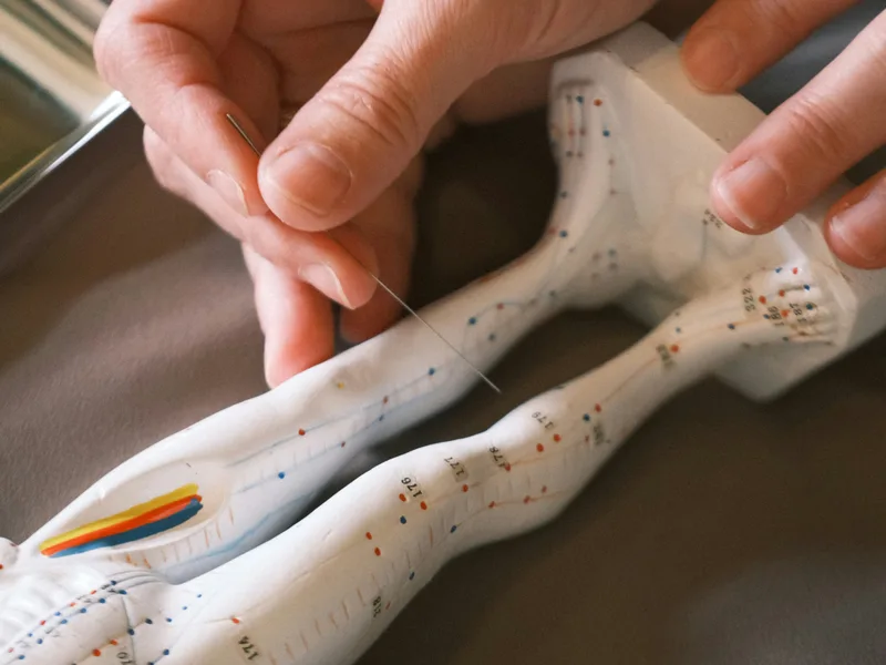 Acupuncture at ProKinetic in Fort Scott
