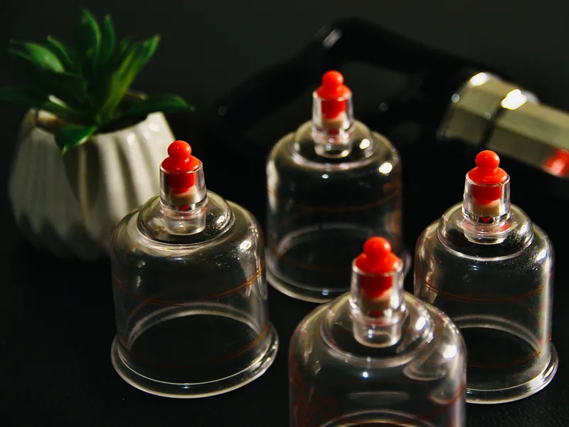 How Cupping Therapy works at ProKinetic