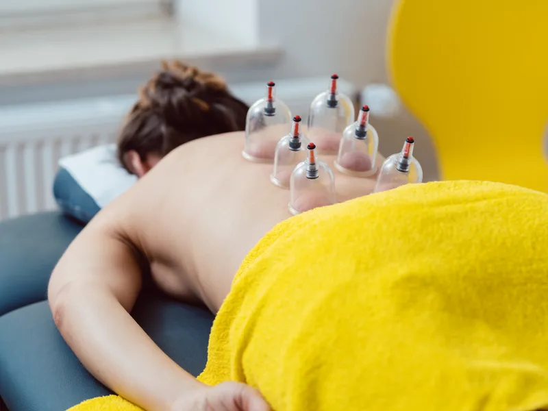 Cupping Therapy at ProKinetic in Fort Scott