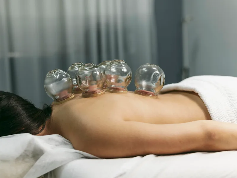 Cupping Therapy at ProKinetic in Fort Scott