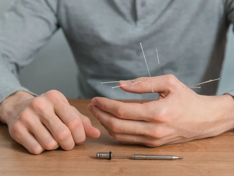 Dry Needling at ProKinetic in Fort Scott