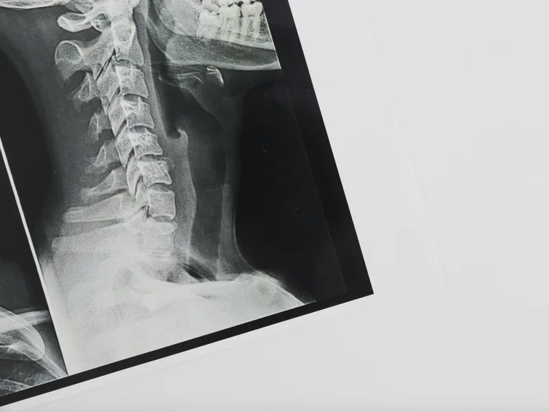 X-Rays at ProKinetic in Fort Scott