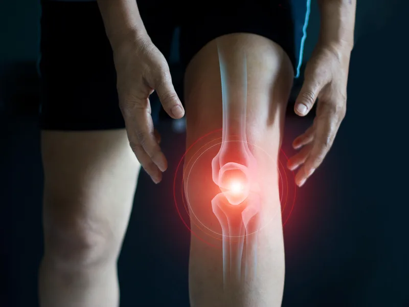 How ProKinetic treats arthritis in Fort Scott